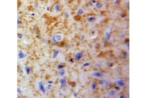 IHC-P analysis of Brain tissue, with DAB staining. (LCP2 抗体  (AA 202-463))