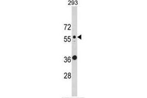 Western blot analysis of KRT10 Antibody (N-term) in 293 cell line lysates (35ug/lane). (Keratin 10 抗体  (N-Term))