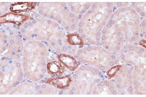 Immunohistochemistry of paraffin-embedded Rat kidney using UGT2B15 Polyclonal Antibody at dilution of 1:100 (40x lens). (UGT2B15 抗体)
