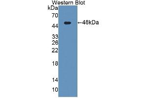 Western blot analysis of the recombinant protein. (KNG1 抗体  (AA 19-380))