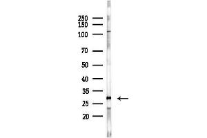 anti-Synaptosomal-Associated Protein, 25kDa (SNAP25) (C-Term) antibody
