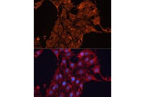Immunofluorescence analysis of C6 cells using  antibody (ABIN6131156, ABIN6136521, ABIN6136522 and ABIN6223942) at dilution of 1:100. (ADAM12 抗体  (AA 589-738))