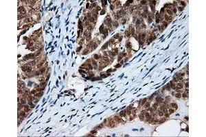 Immunohistochemical staining of paraffin-embedded Kidney tissue using anti-FAHD2A mouse monoclonal antibody. (FAHD2A 抗体)
