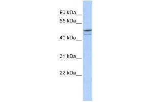 WB Suggested Anti-DMRTA1 Antibody Titration: 0. (DMRTA1 抗体  (Middle Region))