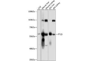 Western blot analysis of extracts of various cell lines, using FTCD antibody (ABIN6133518, ABIN6140789, ABIN6140790 and ABIN6225015) at 1:1000 dilution. (FTCD 抗体  (AA 412-541))