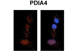 Immunohistochemistry with Rat Brain lysate tissue (PDIA4 抗体  (N-Term))