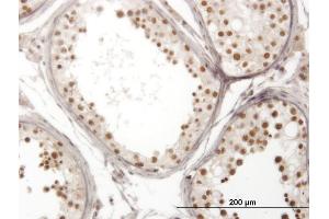 Immunoperoxidase of monoclonal antibody to NOL4 on formalin-fixed paraffin-embedded human testis. (NOL4 抗体  (AA 425-524))