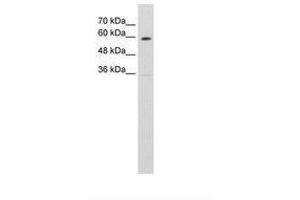 Image no. 1 for anti-Solute Carrier Family 11 (Proton-Coupled Divalent Metal Ion Transporters), Member 1 (SLC11A1) (AA 401-450) antibody (ABIN205005)