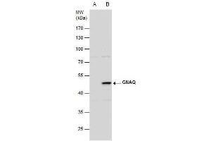 WB Image GNAQ antibody detects GNAQ protein by western blot analysis. (GNAQ 抗体  (Center))