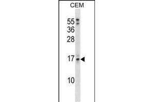 SOSTDC1 Antibody (C-term) (ABIN1536776 and ABIN2849017) western blot analysis in CEM cell line lysates (35 μg/lane). (SOSTDC1 抗体  (C-Term))
