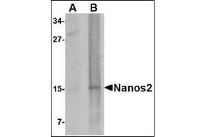 Western blot analysis of Nanos2 in rat brain tissue lysate with this product at (A) 1 and (B) 2 μg/ml. (NANOS2 抗体  (N-Term))
