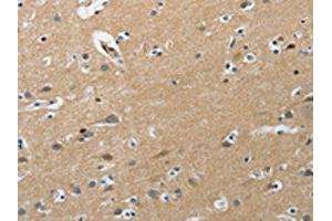 Immunohistochemistry (IHC) image for anti-Phosphatidylinositol-4-Phosphate 5-Kinase, Type I, gamma (PIP5K1C) antibody (ABIN7191891)