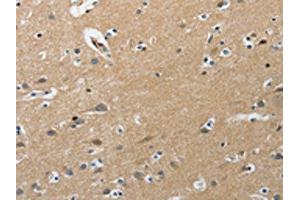 The image on the left is immunohistochemistry of paraffin-embedded Human brain tissue using ABIN7191891(PIP5K1C Antibody) at dilution 1/25, on the right is treated with synthetic peptide. (PIP5K1C 抗体)