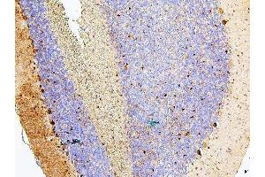 IHC analysis of MTR using anti-MTR antibody (ABIN7602599).