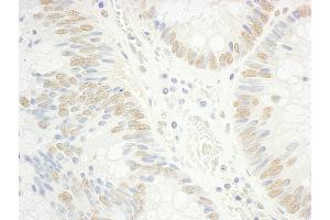 anti-General Transcription Factor IIF, Polypeptide 1, 74kDa (GTF2F1) (AA 250-300) antibody