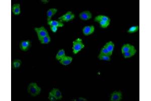 Immunofluorescence staining of HepG2 cells with ABIN7142996 at 1:133, counter-stained with DAPI. (ASIC1 抗体  (AA 195-297))