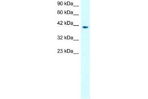 CHRNA1 antibody used at 1. (CHRNA1 抗体)