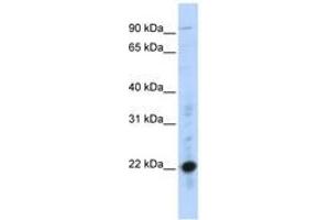 Image no. 1 for anti-Cysteine-Rich Protein 2 (CRIP2) (C-Term) antibody (ABIN6740380) (CRIP2 抗体  (C-Term))