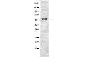Western blot analysis of TSYL2 expression in HEK293 cells ,The lane on the left is treated with the antigen-specific peptide. (TSPY-Like 2 抗体  (Internal Region))