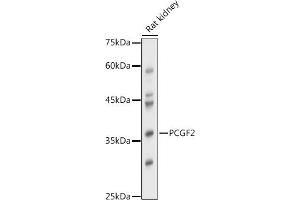 Western blot analysis of extracts of Rat kidney, using PCGF2 antibody (ABIN7269450) at 1:1000 dilution. (PCGF2 抗体)