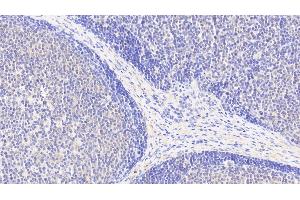 Detection of ACAT1 in Human Lymph node Tissue using Polyclonal Antibody to Acetyl Coenzyme A Acetyltransferase 1 (ACAT1) (ACAT1 抗体  (AA 111-427))