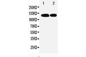Anti-p107 antibody, Western blotting Lane 1: 239T Cell Lysate Lane 2: JURKAT Cell Lysate (p107 抗体  (C-Term))