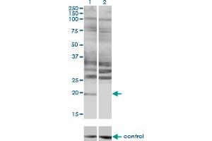 Western blot analysis of HAND2 over-expressed 293 cell line, cotransfected with HAND2 Validated Chimera RNAi (Lane 2) or non-transfected control (Lane 1).