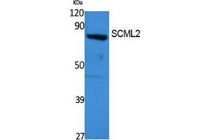 Western Blotting (WB) image for anti-Sex Comb On Midleg-Like 2 (SCML2) (Internal Region) antibody (ABIN3187657) (SCML2 抗体  (Internal Region))