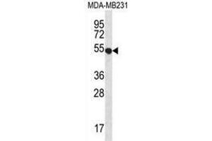 Western blot analysis in MDA-MB231 cell line lysates (35ug/lane) using GPR34  Antibody . (GPR34 抗体  (Middle Region))