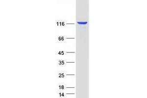Western Blotting (WB) image for Ubiquitin Specific Peptidase 7 (Herpes Virus-Associated) (USP7) protein (Myc-DYKDDDDK Tag) (ABIN2735144)