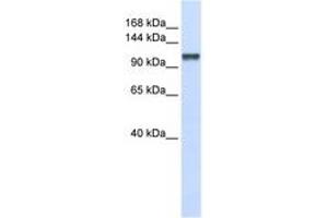 Image no. 1 for anti-Calcium Homeostasis Endoplasmic Reticulum Protein (CHERP) (C-Term) antibody (ABIN6740689) (CHERP 抗体  (C-Term))