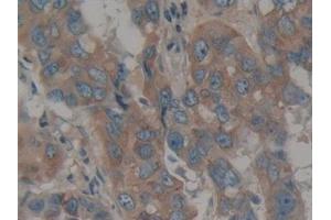 Immunohistochemistry (IHC) image for anti-Calumenin (CALU) (AA 20-315) antibody (ABIN7434203)