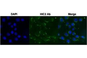 Immunofluorescent staining of Huh7 cell with HIC2 polyclonal antibody  under 4 ug/mL working concentration. (HIC2 抗体  (AA 395-444))
