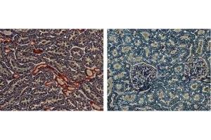 Immunohistochemistry (IHC) image for anti-Potassium Inwardly-Rectifying Channel, Subfamily J, Member 1 (KCNJ1) (AA 342-391) antibody (ABIN7043467)