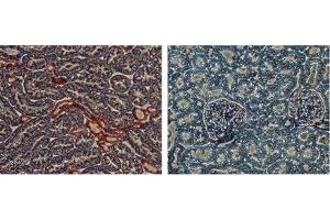Expression of KCNJ1 in rat kidney - Immunohistochemical staining of rat kidney sections using Anti-KCNJ1 (Kir1. (KCNJ1 抗体  (C-Term, Intracellular))