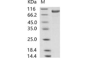 MERS-Coronavirus Spike Protein (MERS-CoV S) (Active) protein (His tag)
