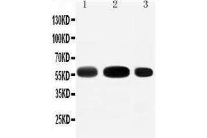 Anti-EAAT3 antibody, Western blotting Lane 1: Rat Liver Tissue Lysate Lane 2: Rat Heart Tissue Lysate Lane 3: HEPA Cell Lysate