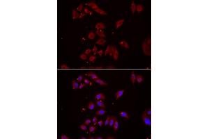 Immunofluorescence analysis of U2OS cells using NPHP1 antibody (ABIN5974022). (NPHP1 抗体)