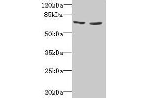 Western blot All lanes: TNFRSF11A antibody at 2 μg/mL Lane 1: EC109 whole cell lysate Lane 2: 293T whole cell lysate Secondary Goat polyclonal to rabbit IgG at 1/15000 dilution Predicted band size: 67, 33, 37, 29, 57, 65 kDa Observed band size: 67 kDa (TNFRSF11A 抗体  (AA 28-202))