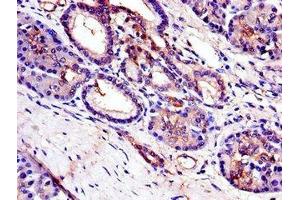Immunohistochemistry of paraffin-embedded human pancreatic tissue using ABIN7173365 at dilution of 1:100 (TRIB3 抗体  (AA 152-325))
