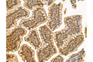 ABIN6260867 and ABIN6266510 at 1/100 staining Rat colon tissue by IHC-P.