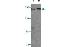 Western blot analysis of KLOTHO in rat heart tissue lysate with KL polyclonal antibody  at 1 ug/mL (lane 1) and 2 ug/mL (lane 2). (Klotho 抗体  (AA 410-460))
