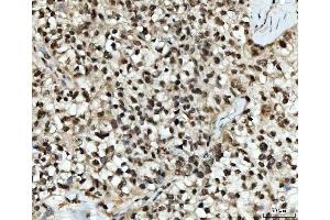 IHC analysis of Ubc13/UBE2N using anti-Ubc13/UBE2N antibody (ABIN7599924).