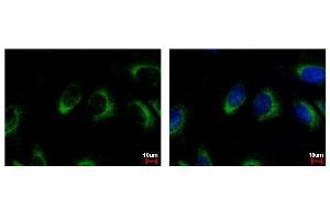 ICC/IF Image NQO2 antibody detects NQO2 protein at cytoplasm by immunofluorescent analysis. (NQO2 抗体  (Center))