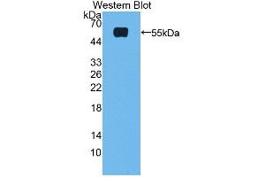 Detection of Recombinant FXR, Rat using Polyclonal Antibody to Farnesoid X Receptor (FXR) (NR1H4 抗体  (AA 375-568))