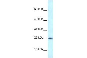 WB Suggested Anti-Rbm3 Antibody   Titration: 1. (RBM3 抗体  (N-Term))