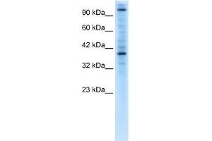 Human Jurkat; WB Suggested Anti-ZNF624 Antibody Titration: 0. (ZNF624 抗体  (Middle Region))