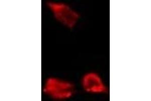 ABIN6278012 staining Hela by IF/ICC. (Calpain S1 抗体  (Internal Region))