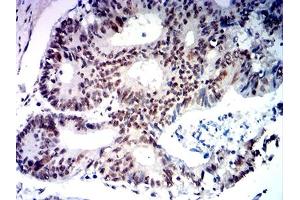 Immunohistochemistry (IHC) image for anti-N-Myc Proto-Oncogene Protein (MYCN) (AA 337-464) antibody (ABIN7193585)