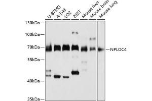 Western blot analysis of extracts of various cell lines, using NPLOC4 antibody (ABIN1681086, ABIN5664262, ABIN5664264 and ABIN6220175) at 1:3000 dilution. (NPLOC4 抗体  (AA 1-270))